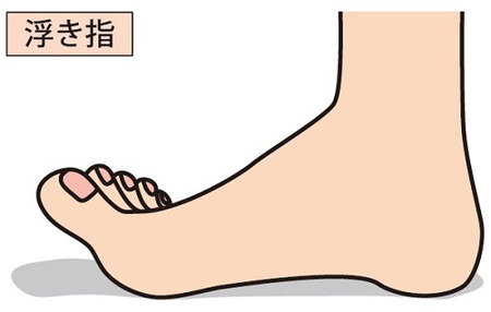 足の指を使って歩いていますか？