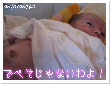 へその緒がとれました♪