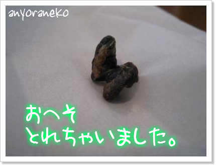へその緒がとれました♪