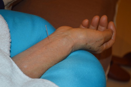膝痛の鍼治療症例(47) 膝痛の鍼治療症例(47)