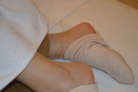 腰痛の鍼治療症例(20) 腰痛の鍼治療症例(20)