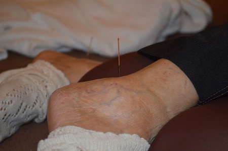 腰痛の鍼治療症例(41) 腰痛の鍼治療症例(41)