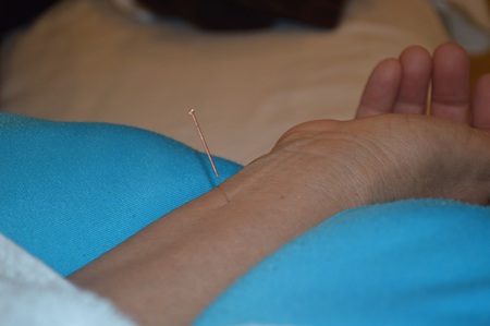 膝痛の鍼治療症例(45) 膝痛の鍼治療症例(45)