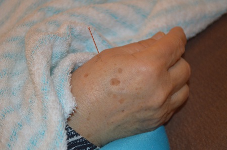 膝痛の鍼治療症例(52) 膝痛の鍼治療症例(52)