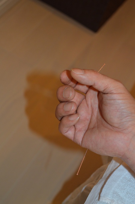 腰痛の鍼治療症例(55) 腰痛の鍼治療症例(55)