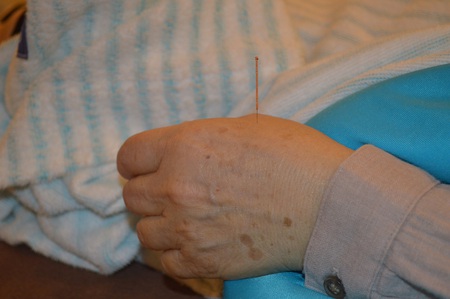 膝痛の鍼治療症例(55) 膝痛の鍼治療症例(55)