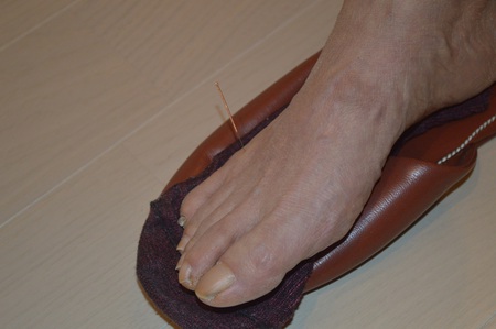 ぎっくり腰の鍼治療症例(41) ぎっくり腰の鍼治療症例(41)