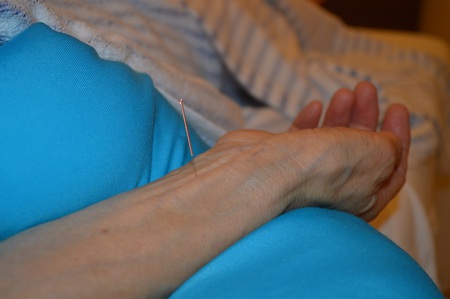 膝痛の鍼治療症例(96) 膝痛の鍼治療症例(96)