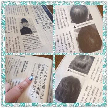 薄毛でお悩みに方へ育毛リンパケア! 薄毛でお悩みに方へ育毛リンパケア!