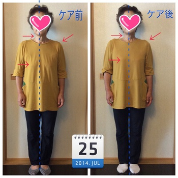 ビフォー&アフター写真! ビフォー&アフター写真!