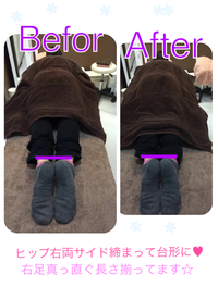 8月キャンペーン&背骨.骨盤矯正