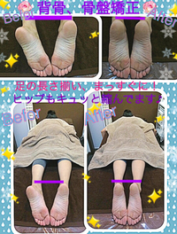 8月キャンペーン&背骨.骨盤矯正