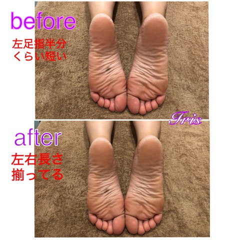 背骨・骨盤矯正でスタイルアップ‼︎綺麗なラインに❤︎❤︎ 背骨・骨盤矯正でスタイルアップ‼︎綺麗なラインに❤︎❤︎