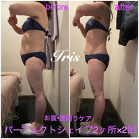 ボディーライン若見えパーフェクトシェイプ 2022/02/27 13:41:46