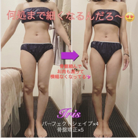 パーフェクトシェイプ&骨盤矯正でスッキリダイエット❤︎ 2023/01/13 11:56:27