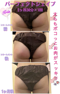 小尻に❤︎綺麗なヒップライン作るパーフェクトシェイプ1回の効果 2022/01/22 19:17:21