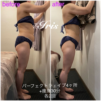 痩身、ダイエットにパーフェクトシェイプ♪痩せたい方に❤︎ 2022/02/17 21:15:57