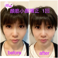 Iris   顔筋小顔矯正 2021/05/18 08:15:26