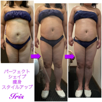 脂肪撃退！痩せたい方に！パーフェクトシェイプ結果写真 2022/05/01 04:01:36