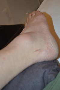 腰痛の鍼治療症例（１０３） 2023/10/16 08:48:39