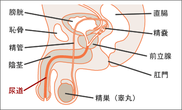 男性　淋菌性尿道炎