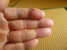 ★トリマーで切った指の顛末★